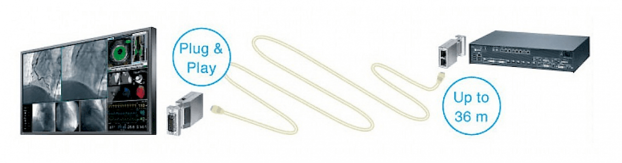 Accessory - TDL - Robust Solution