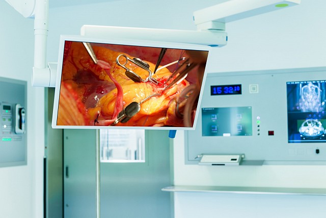 Monitor - EX271W - Exceptional High-Brightness and High-Definition