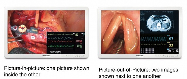 Panasonic - Dual Display