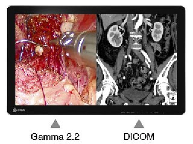 Monitor - Endo 3D - Independent Adjustment