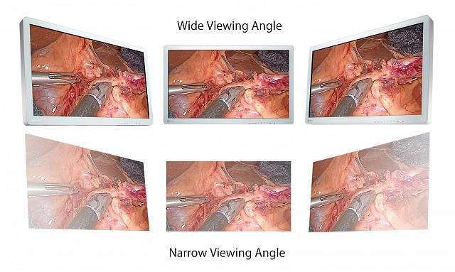 Monitor - Endo 2D - Viewing Angle 32"