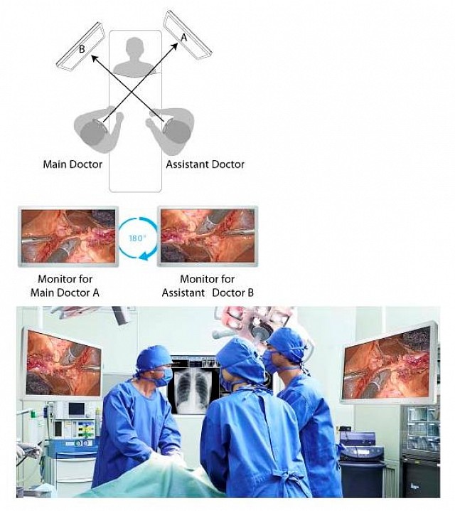 Monitor - Endo 2D - Rotation and Mirroring