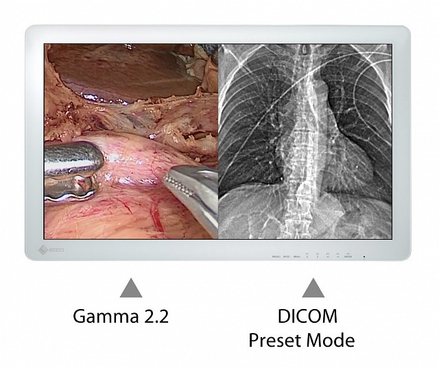 Monitor - Endo 2D - Adjust Independent 26" 27"