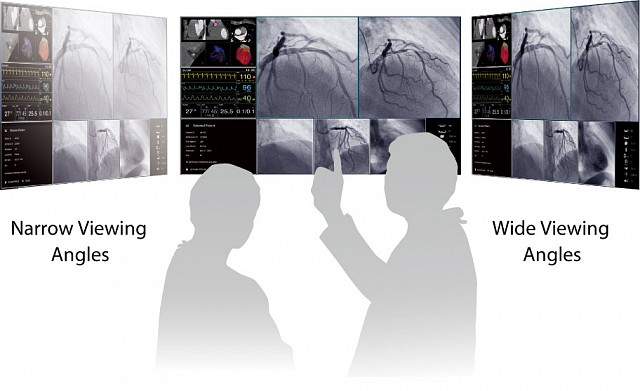 Monitor - LX550W - Uniform Image Quality