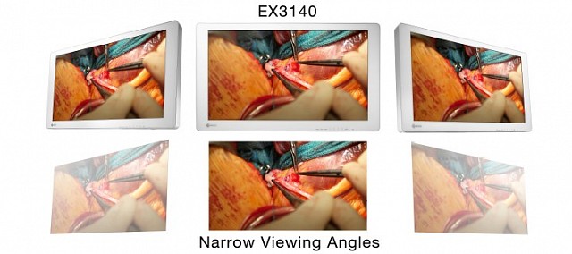 Monitor - Endo 4K - Blickwinkel