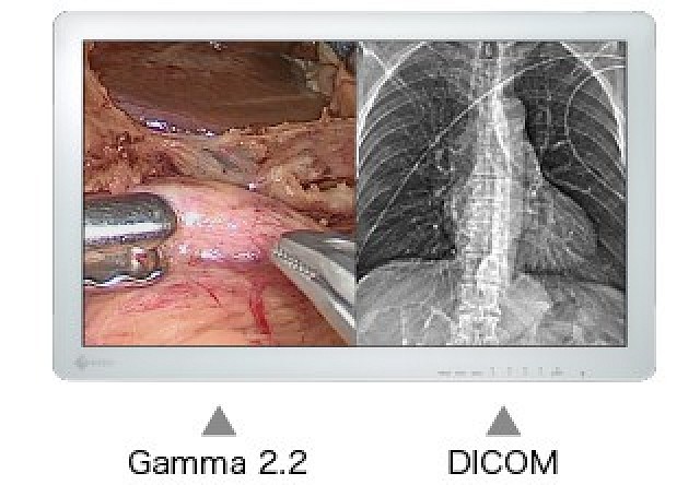 Monitor - Endo 2D - Adjust Independent EX2621