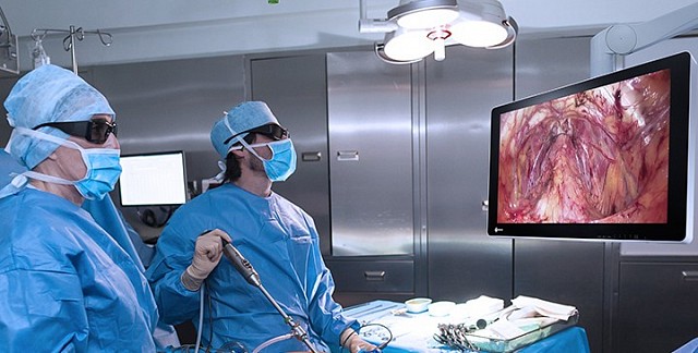 Monitor - Endo 3D 4K - Visibility EX3141