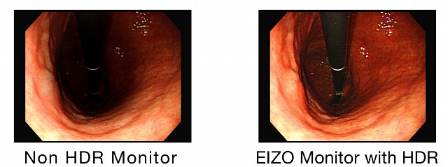 Monitor - Endo 4K - HDR