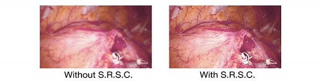 Monitor - Endo - S.R.S.C