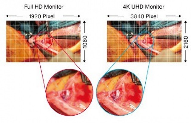 Monitor - Endo 4K - UHD Darstellung EX5841