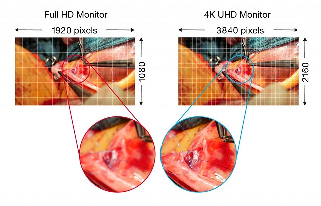 Monitor - Endo 4K - UHD Display EX5841
