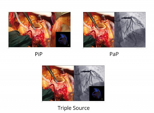 Monitor - Endo 4K - Multiple Signals EX5841