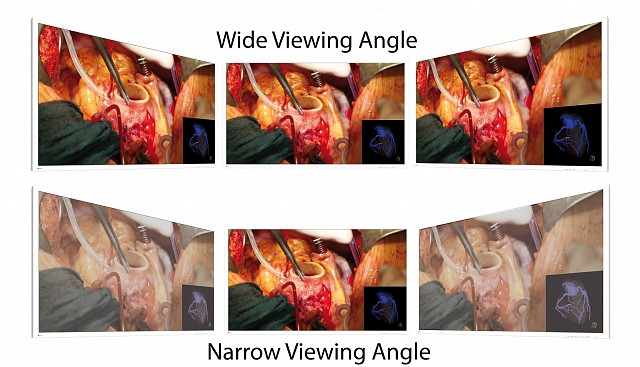 Monitor - Endo 4K - Viewing Angle EX5841