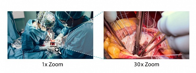 Camera - 4K - Narrow Targets