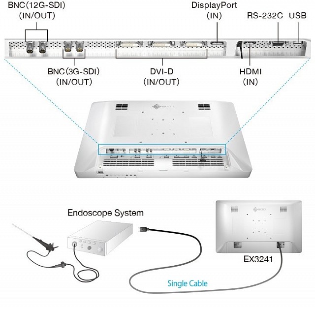 Monitor - Endo 4K - Cable Management EX3241