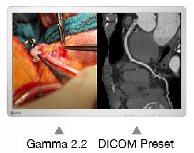 Monitor - Endo 4K - Adjust Screens EX3241