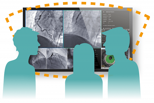 Monitor - LL580W - Comfortably View