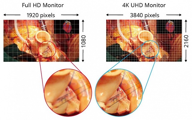 Monitor - Endo 4K - UHD Display EXxx42