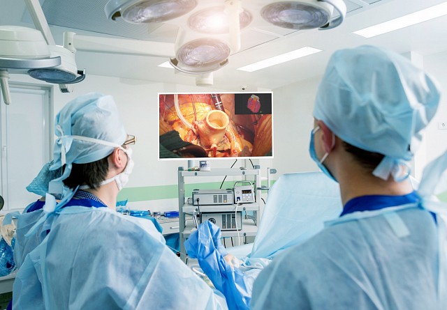 Monitor - Endo 4K - Lightweight and VESA EX4342