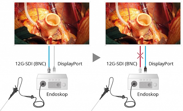 Monitor - Endo 4K - Sichere Anzeige EX4342