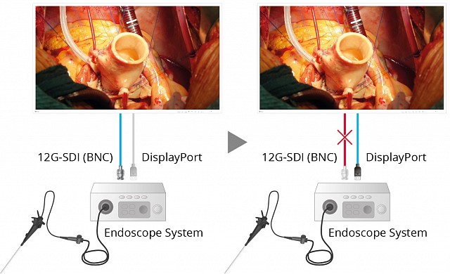 Monitor - Endo 4K - Fail-Safe Display EX4342