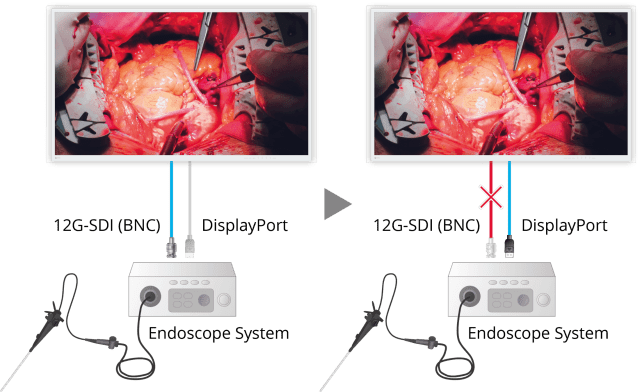 Monitor - Endo 4K - Fail-Safe Display EX4942