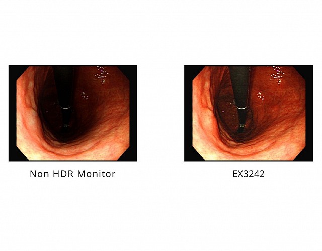 Monitor - Endo 4K - HDR - EX3242