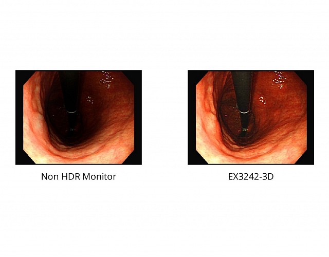 Monitor - Endo 4K - HDR - EX3242-3D