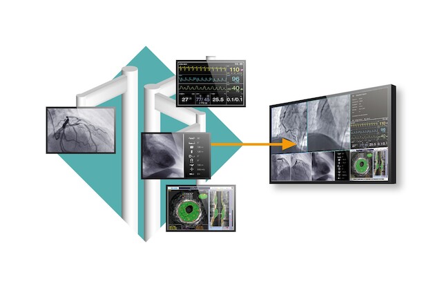 Monitor - Everything in a Single Glance LL550W