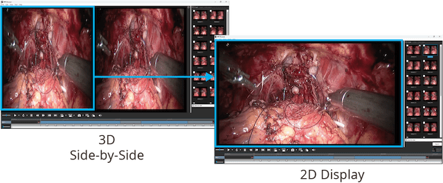 MIR Browser - Referencing